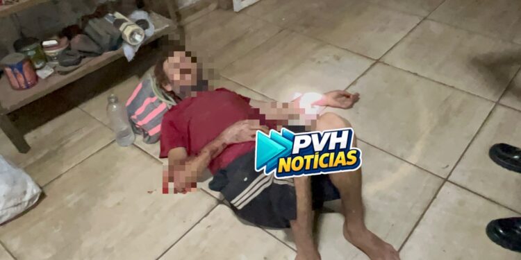 URGENTE: Homem pede socorro após ter os dois braços quebrados durante espancamento