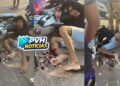 URGENTE: Motociclista quebra perna em grave acidente na zona leste
