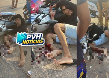 URGENTE: Motociclista quebra perna em grave acidente na zona leste