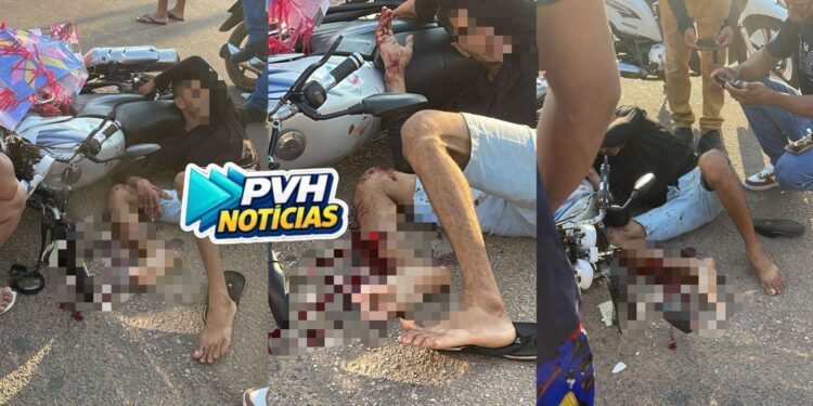 URGENTE: Motociclista quebra perna em grave acidente na zona leste