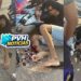 URGENTE: Motociclista quebra perna em grave acidente na zona leste