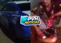 URGENTE: Homem é atacado a facadas próximo de condomínio na zona leste