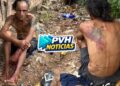 URGENTE: Usuário de drogas é espancado por causa de dívida com traficantes na zona leste